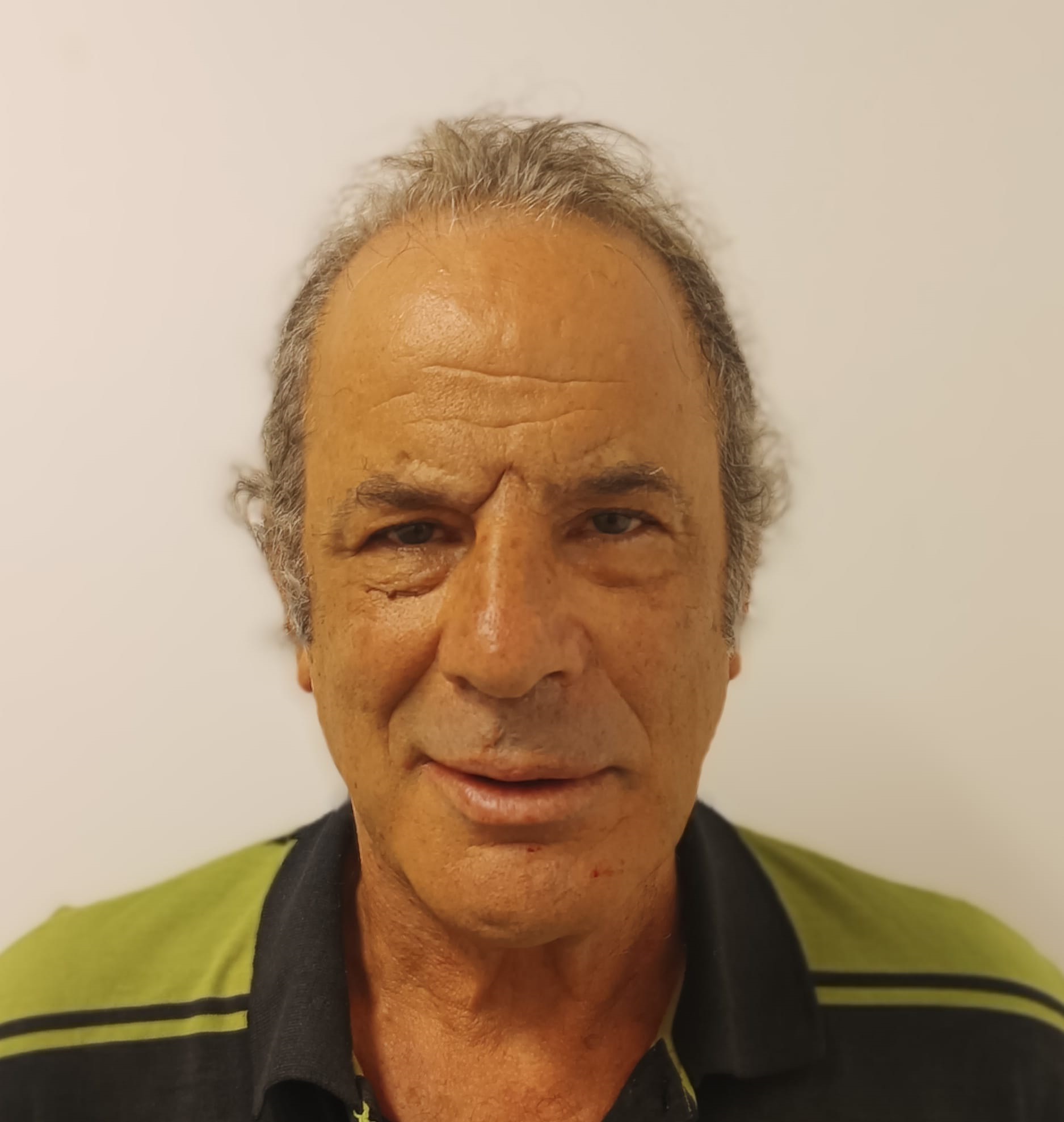 דורון לוקס